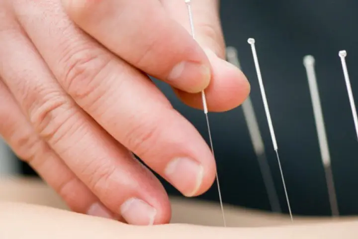 Alternative Weight Loss Therapy